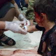 الطفل في هذه الصورة أصيب في حلب وليس بعفرين