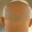 Bald men will not be able to turn the sun into energy