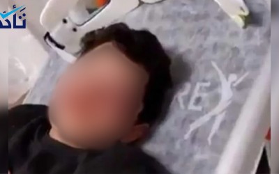 والد الطفل المعتدى عليه بالضرب في أنطاليا ينفي لـ(تأكد) تعرض ابنه للاغتصاب
