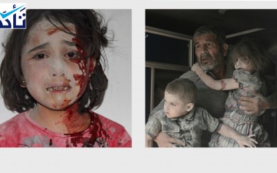 هاتان الصورتان ليستا لأطفال تعرضوا للقصف في اليمن