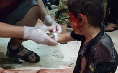 Child in this photo was injured in Aleppo not Efrin