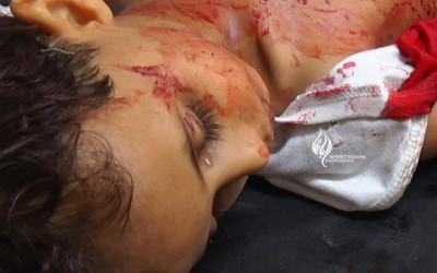الطفل ذو "الدموع العالقة" قتل في اليمن وليس في سوريا أو مصر