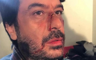هل تعرض الممثل السوري ميلاد يوسف لاعتداء بالضرب في دمشق؟
