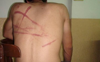 This photo is not for ex-detainee in PYD prison