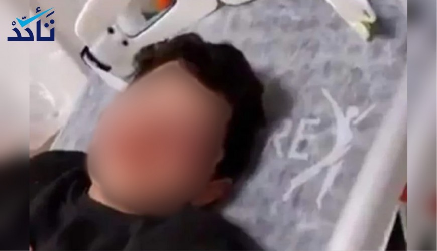 والد الطفل المعتدى عليه بالضرب في أنطاليا ينفي لـ(تأكد) تعرض ابنه للاغتصاب
