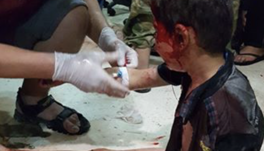 الطفل في هذه الصورة أصيب في حلب وليس بعفرين